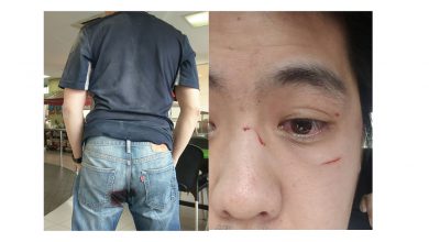 Photo of 撞車遇路霸 哥臀挨刀 弟眼割傷