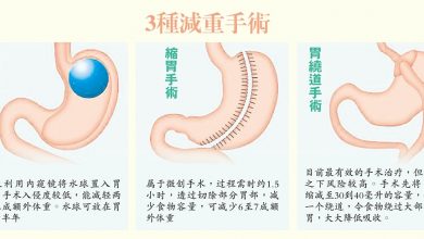 Photo of 【醫生訪醫生】糖尿肥胖惡性循環 3種手術破魔咒