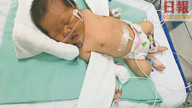 Photo of 三週大前須動手術 心疾小寶寶需9萬救命