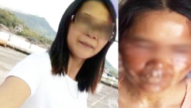 Photo of 壓力鍋爆炸 女毀容 製造商：去叫店家賠