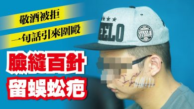 Photo of 敬酒被拒說了一句 男子遭圍毆 臉縫百針