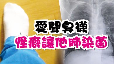 Photo of 聞臭襪成癖  男子肺染菌