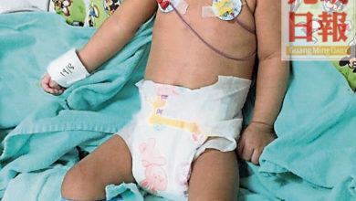 Photo of 2男女嬰患心疾 亟需13萬手術費
