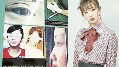 Photo of 整容醫院盜用楊紫照片 僅眼睛打上馬賽克
