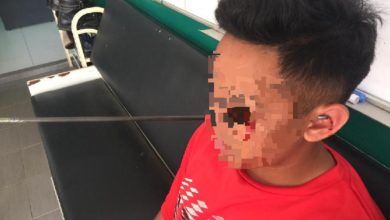 Photo of 4中學生練習射擊  誤射男同學眼角