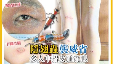 Photo of 隱翅蟲襲威省高樓 多人中招皮腫流膿