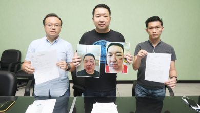 Photo of 疑事業得意招眼紅 理財導師被打爆眼骨