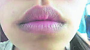 嘴唇變成白或藍紫色
