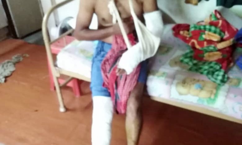孟加拉籍員工左手及右腳骨折。