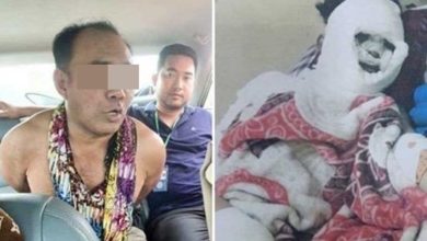 Photo of 情人提分手 惡男起殺機剁掌潑酸溶液