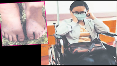 Photo of 雙腳麻痹浮腫 何芸妮入院治療