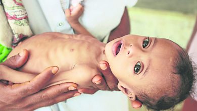 Photo of 也門恐現世界級饑荒  聯國警告或數百萬人死
