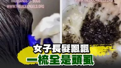 Photo of 女子長髮飄飄 一梳全是頭虱