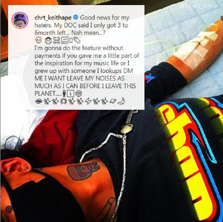 Keith Ape 在個人 Instagram 上正式宣佈他被醫生診斷，自身壽命因為疾病即將終結。