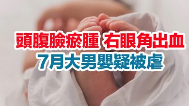 Photo of 頭腹臉瘀腫 右眼角出血 7月大男嬰疑被虐
