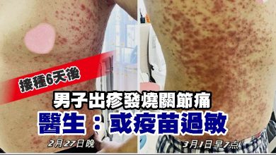 Photo of 男子接種6天後出疹發燒關節痛 醫生：或疫苗過敏