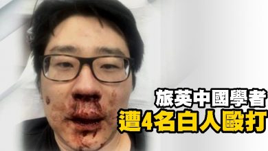 Photo of 旅英中國學者遭4名白人毆打