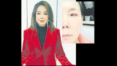 Photo of 辛曉琪驚爆眼睛爆血管