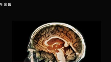 Photo of 研究發現 逾三分一冠病治愈者腦部有問題