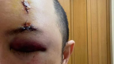Photo of 賠千元打發受害者？  傷者斥基建公司沒誠意