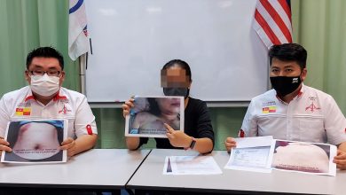 Photo of 不肯親熱就拳打腳踢   女中醫師遭男友暴力致傷