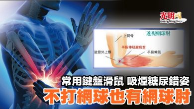 Photo of 常用鍵盤滑鼠 吸煙糖尿錯姿 不打網球也有網球肘
