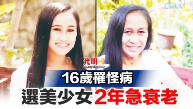 Photo of 16歲罹怪病 選美少女2年急衰老