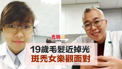 Photo of 19歲毛髮近掉光 斑禿女樂觀面對