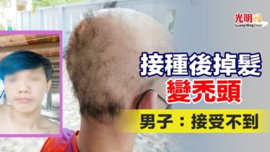 Photo of 接種後掉髮變禿頭 男子：接受不到