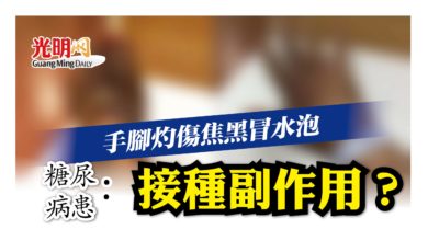 Photo of 糖尿病患揭冠病疫苗副作用 接種後手腳灼傷焦黑冒水泡