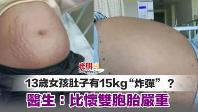 Photo of 13歲女孩肚子有15kg“炸彈”？ 醫生：比懷雙胞胎嚴重