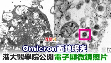 Photo of Omicron面貌曝光 港大醫學院公開電子顯微鏡照片