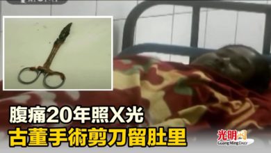 Photo of 腹痛20年照X光 古董手術剪刀留肚里