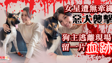 Photo of TVB女星遭無牽繩惡犬襲擊！狗主逃離現場留一片血跡