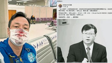 Photo of 王喜PCR遭戳滿臉濺血 入境台灣鬧上警局