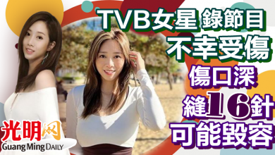 Photo of TVB女星錄節目不幸受傷  傷口深縫16針可能毀容