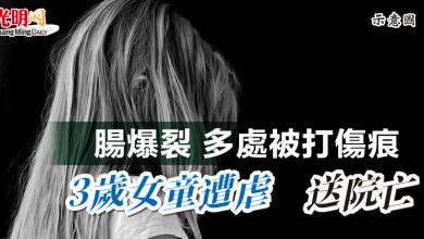Photo of 腸爆裂 多處被打傷痕    3歲女童遭虐 送院亡