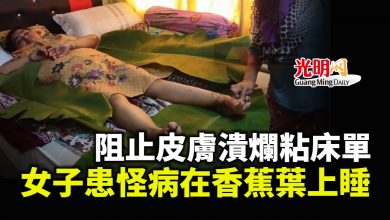 Photo of 阻止皮膚潰爛粘床單 女子患怪病在香蕉葉上睡