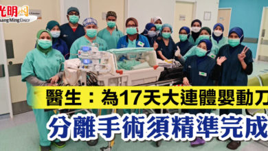 Photo of 醫生：為17天大連體嬰動刀  分離手術須精準完成