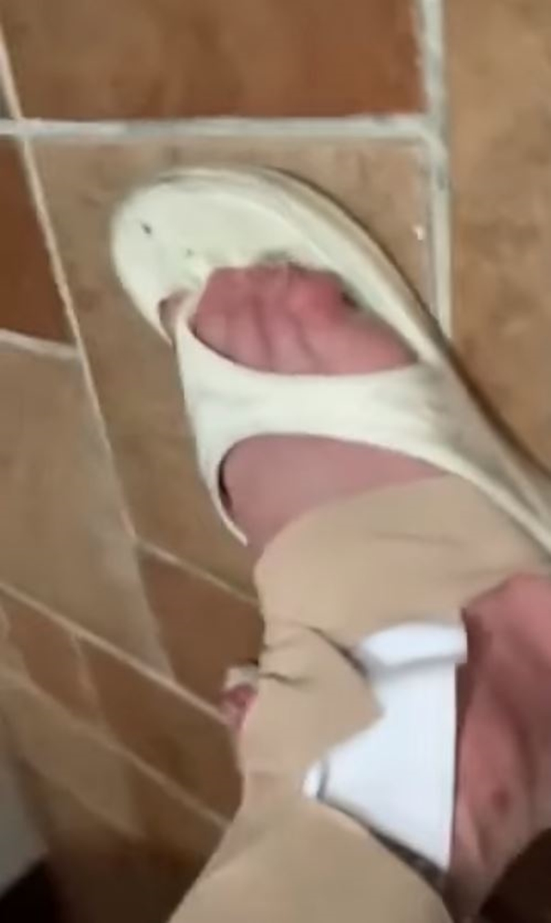 他右腳踝綁著彈性繃帶，腿都彎不下去