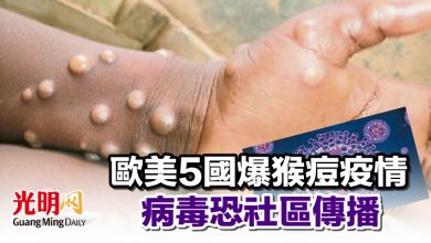 Photo of 歐美5國爆猴痘疫情 病毒恐社區傳播