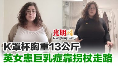 Photo of K罩杯胸重13公斤 英女患巨乳症靠拐杖走路