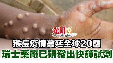 Photo of 猴痘疫情蔓延全球20國 瑞士藥廠已研發出快篩試劑