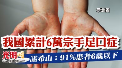Photo of 我國累計6萬宗手足口症  諾希山：91%患者6歲以下