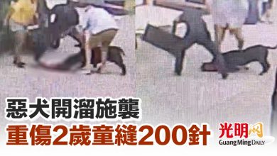 Photo of 惡犬開溜施襲 重傷2歲童縫200針