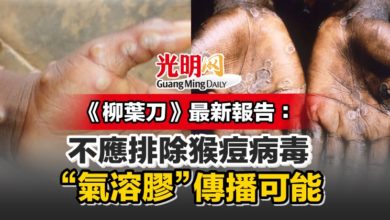 Photo of 《柳葉刀》最新報告：不應排除猴痘病毒“氣溶膠”傳播可能