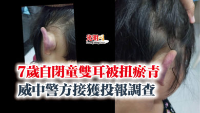 Photo of 7歲自閉童雙耳被扭瘀青  威中警方接獲投報調查