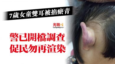 Photo of 7歲女童雙耳被掐瘀青  警已開檔調查 促民勿再渲染