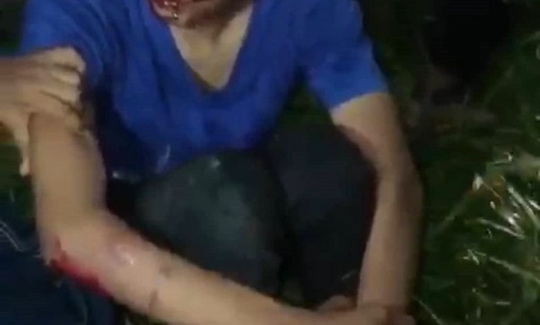 一名傷者口吐鮮血坐在路邊等候救護車。