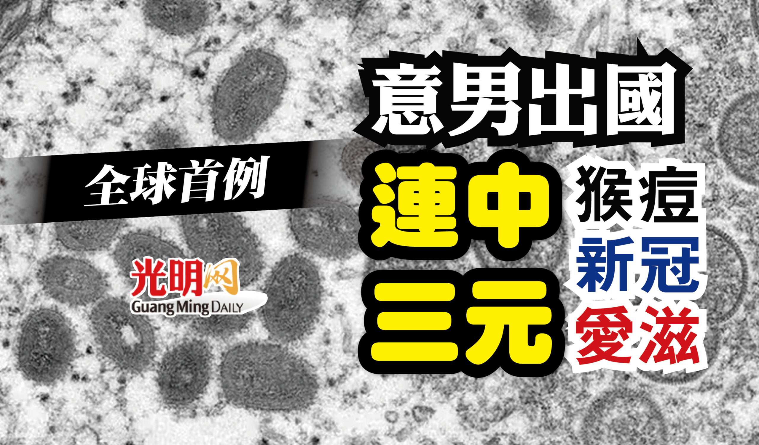 全球首例意男出國感染猴痘新冠愛滋 精選 新型冠狀病毒 即時 國際 22 08 25 光明日报